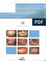 ARCO RECTO CONVENCIONAL (Alfredo Nappa) PDF