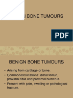 Benign Bone Tumours