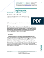 Acute Cerebral Infarction Masked by A Brain Tumor: Kwo-Whei Lee Chung-Ping Lo