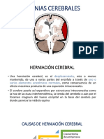 Avances en El Tratamiento de La Tuberculosis Multirresistente