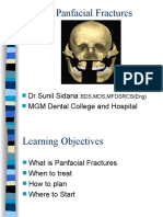 Panfacial Fractures Treatment Guide