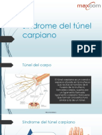 Síndrome túnel carpiano: causas, síntomas y tratamiento