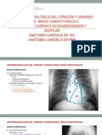 Anatomía cardíaca radiológica