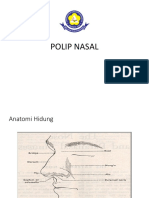 184851205-Ppt-Polip-Nasi