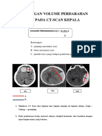 171432883-volume-darah-di-otak.docx