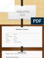 Keratitis