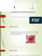 Varices Esofagicas