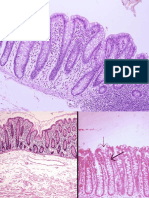 C2-Boala Crohn Si Rectocolita Ulcerohemoragica PDF