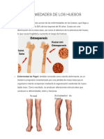 Enfermedades de Los Huesos