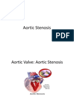  Stenosis Aorta