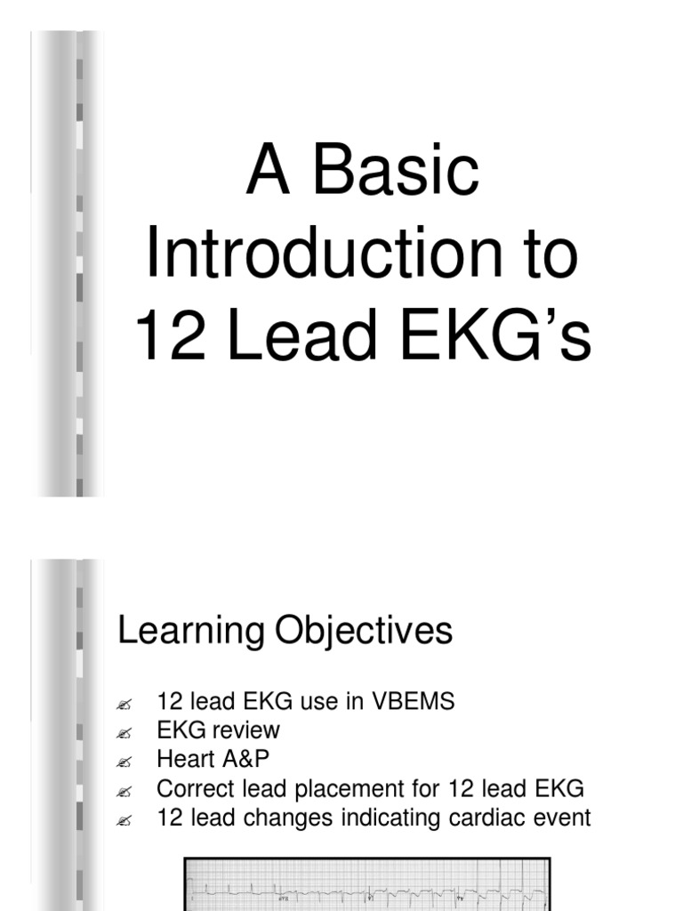 12 Lead EKGs | PDF | Electrocardiography | Coronary Circulation