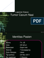 75564964 Tumor Cavum Nasi