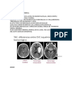 NEUROLOGIA