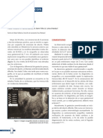 Gestacion Anembronada