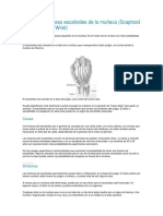 Fractura Del Hueso Escafoides de La Muñeca