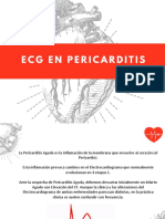 Pericarditis Aguda: Etapas EKG y Diferencias con IAM