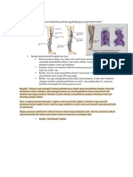 Faktor Risiko dan Diagnosis Awal Varises Vena pada Tungkai