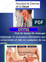 Otitis