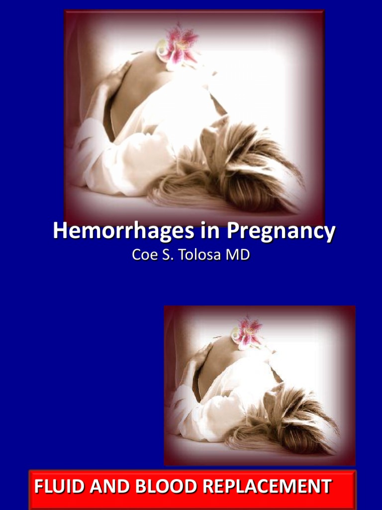 Hemorrhages In Pregnancy Ppt Childbirth Placenta