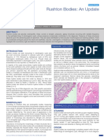 The Dentigerous Cyst As A Potential Ameloblastoma