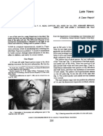 Late Yaws A Case Report.10-Dikompresi PDF