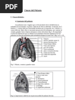 CáncerdelPulmónfinal