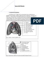 Cáncerdel Pulmónfinal