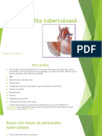 Pericardita tuberculoasă.pptx