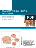 Trigémino Neuralgia Causas y Efectos