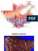 Lembar Balik Hepatitis