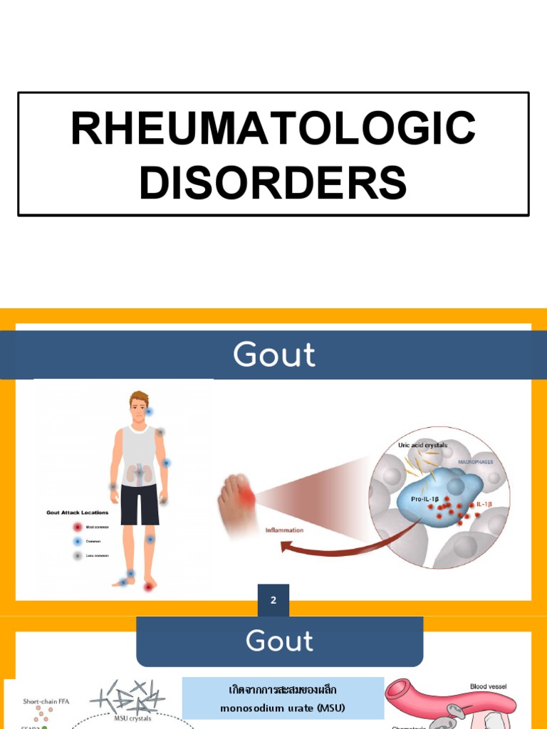 ติว Rheumatology PDF | PDF