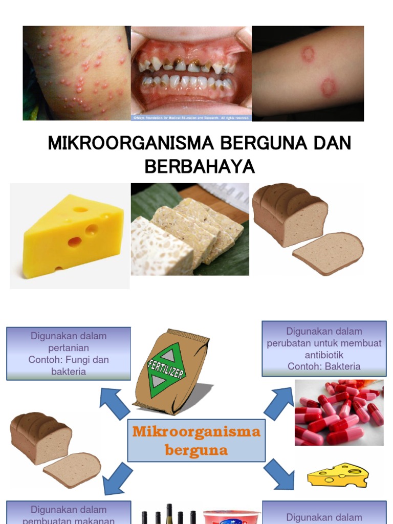Contoh mikroorganisma