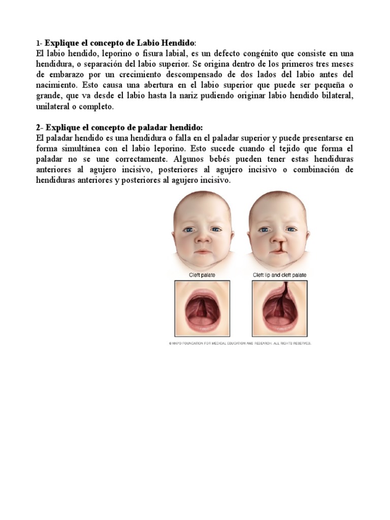 Labio y Paladar Hendido: Clasificación y Epidemiología | PDF ...