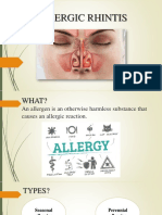 Allergic Rhintis