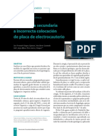 Quemaduras por electrocauterio: Lecciones de un caso clínico