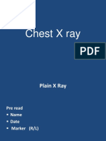 Chest X ray co ass