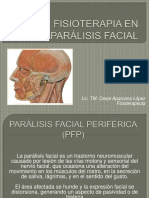 Fisioterapia en Parálisis Facial