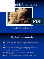 Hydatidiform Mole: NAEEM ULLAH 15/154