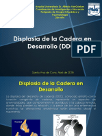 Displasia de Cadera