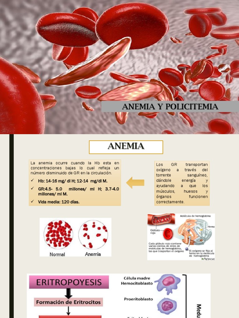 Clasificación y Diagnóstico de Anemia | PDF | Anemia | Sangre