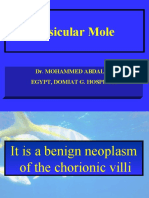 Vesicular Mole: Dr. Mohammed Abdalla Egypt, Domiat G. Hospital