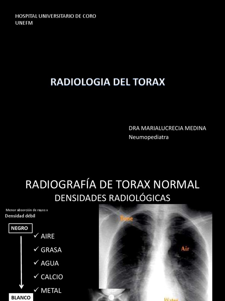 Radiografía de Tórax Normal | PDF | Pulmón | Tórax