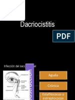 Dacriocistitis