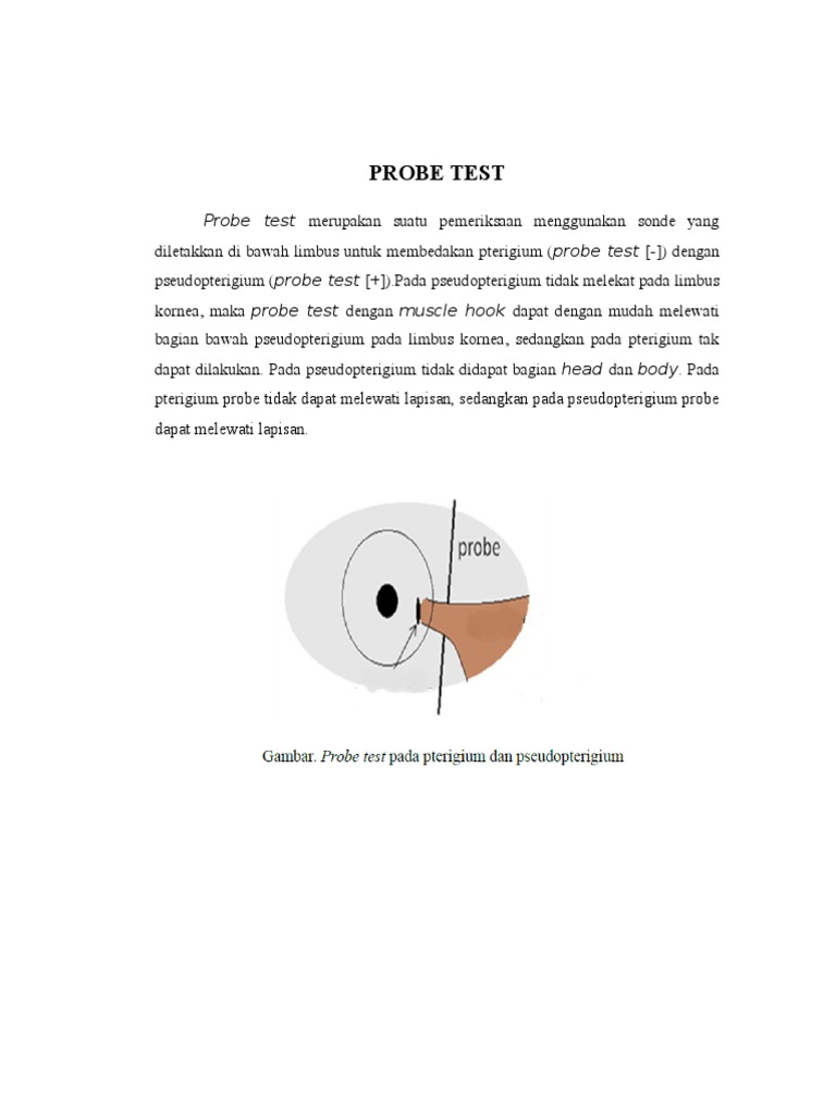 Membedakan Pterigium dan Pseudopterigium Melalui Probe Test PDF
