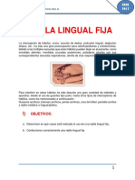 Rejilla lingual fija: confección y efectos terapéuticos