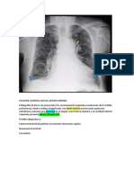 diagnostico