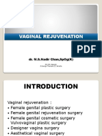 Vaginal Rejuvenation: Dr. M.S.Nadir Chan, Spog (K)