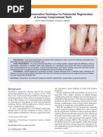 Cairo Classification of Gingival Recession | PDF | Periodontology ...