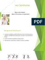 Down Syndrome PPT