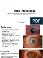 Queratitis infecciosassss profe